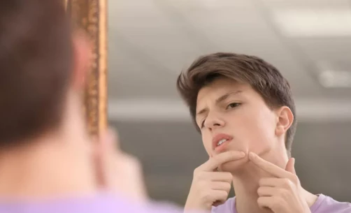 男生生理期会流什么嘛